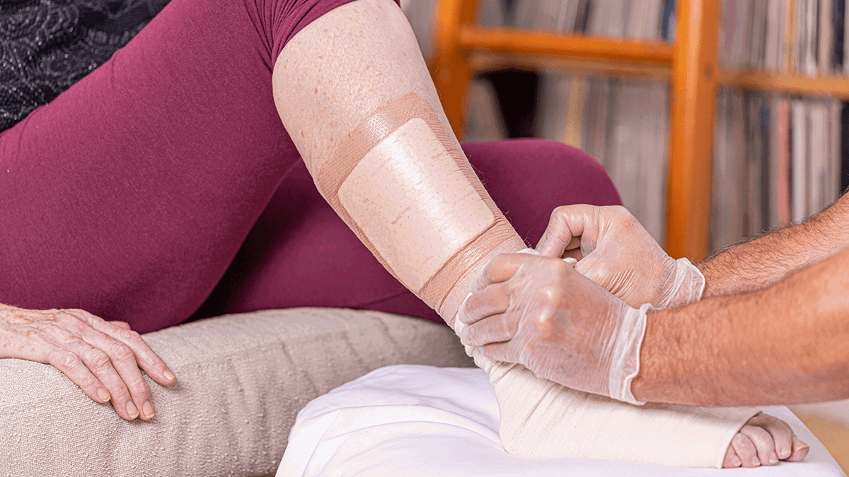A photo of hands applying a Mepilex Border Flex wound dressing on a leg ulcer. 