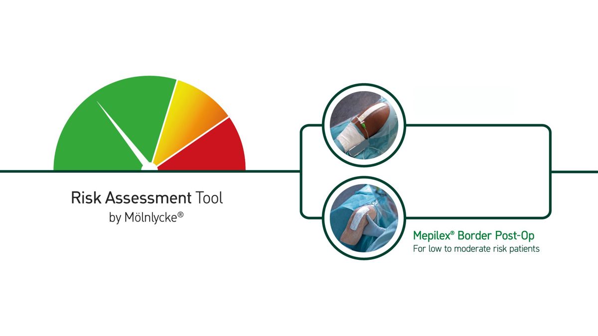 Illustration showing risk assessment tool