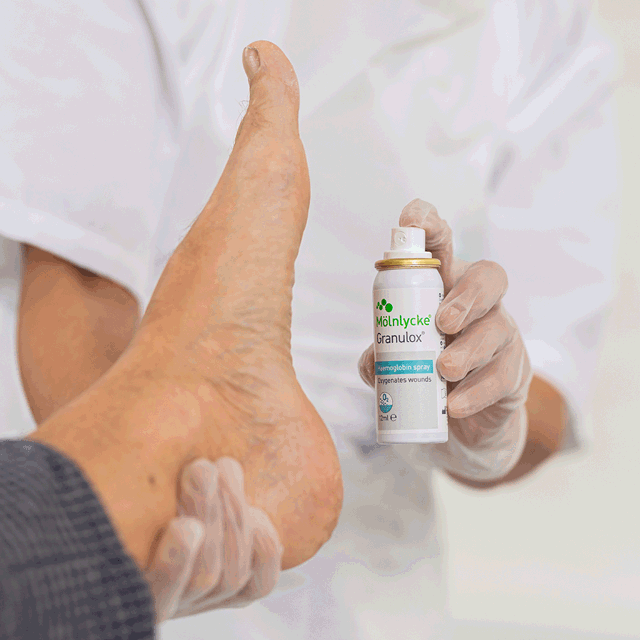 A photo of hand spraying a foot with Granulox. 